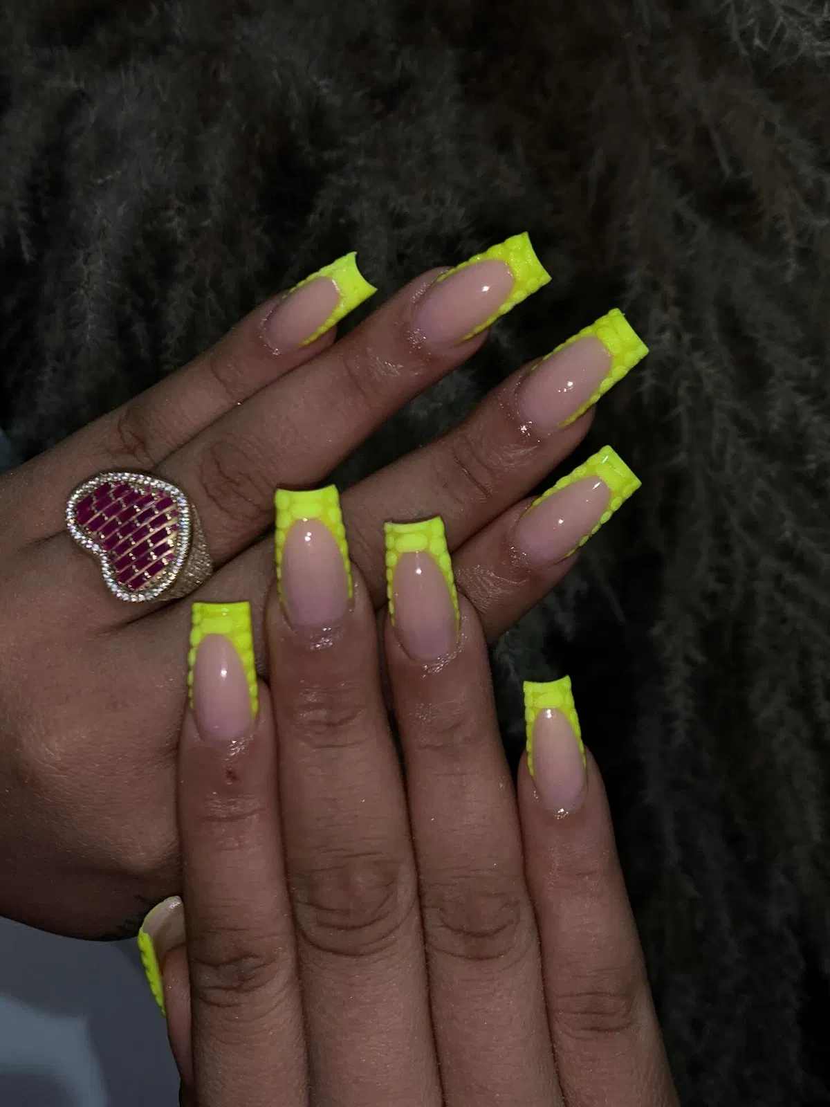 Framed Neon Yellow Tips With Textured Edge Detail