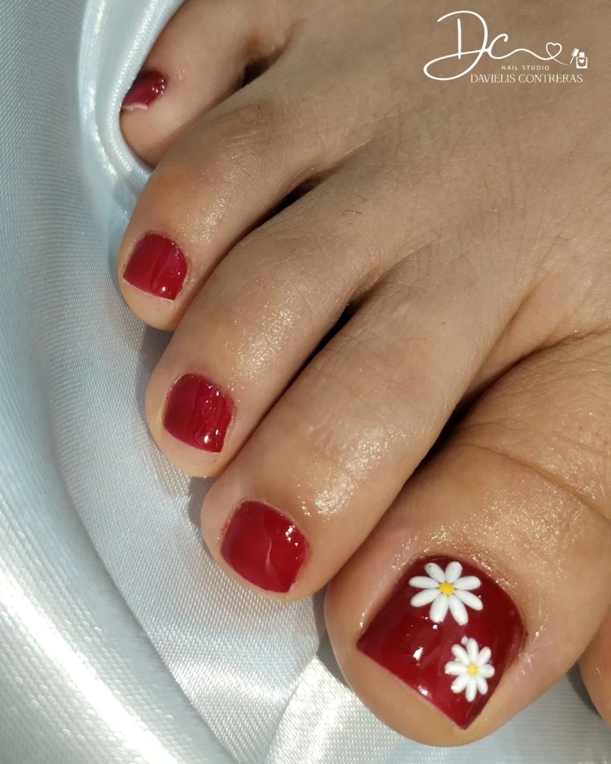 Deep red pedicure with white daisy accents