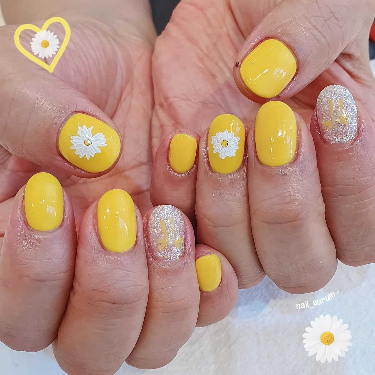 Glossy Yellow with White Daisies and Glitter Accents